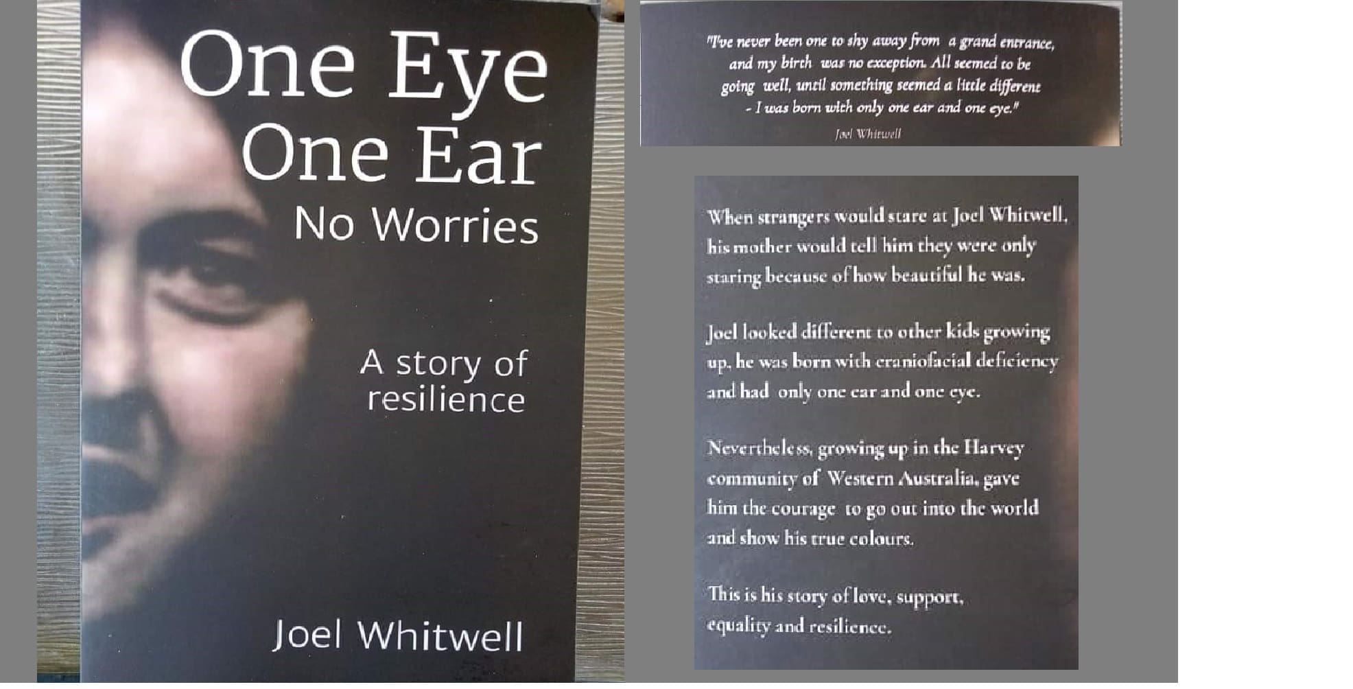 One eye, one ear no worries be inspired by local legend joel whitwell 1 Eventbrite